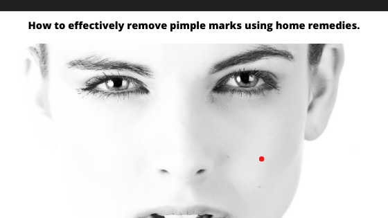 How to effectively remove pimple marks using home remedies.